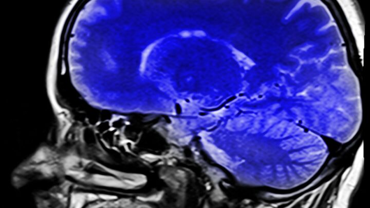 Rezonans magnetyczny — co można zdiagnozować przy jego pomocy?